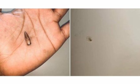woman shares stray bullet experience