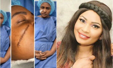 Sonia Ogiri surgery
