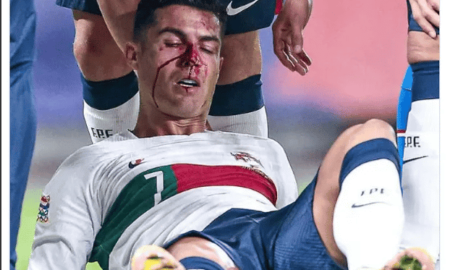 Ronaldo suffers bloodied nose in Portugal match vs Czech Republic after collision with goalie