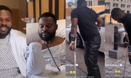 Falz surgery