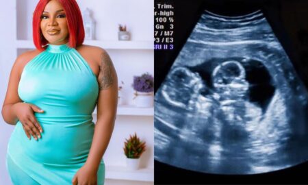 Reactions as Uche Ogbodo shares her ultrasound result